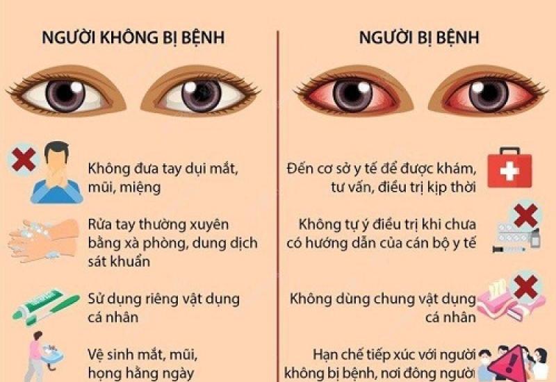 đau mắt đỏ